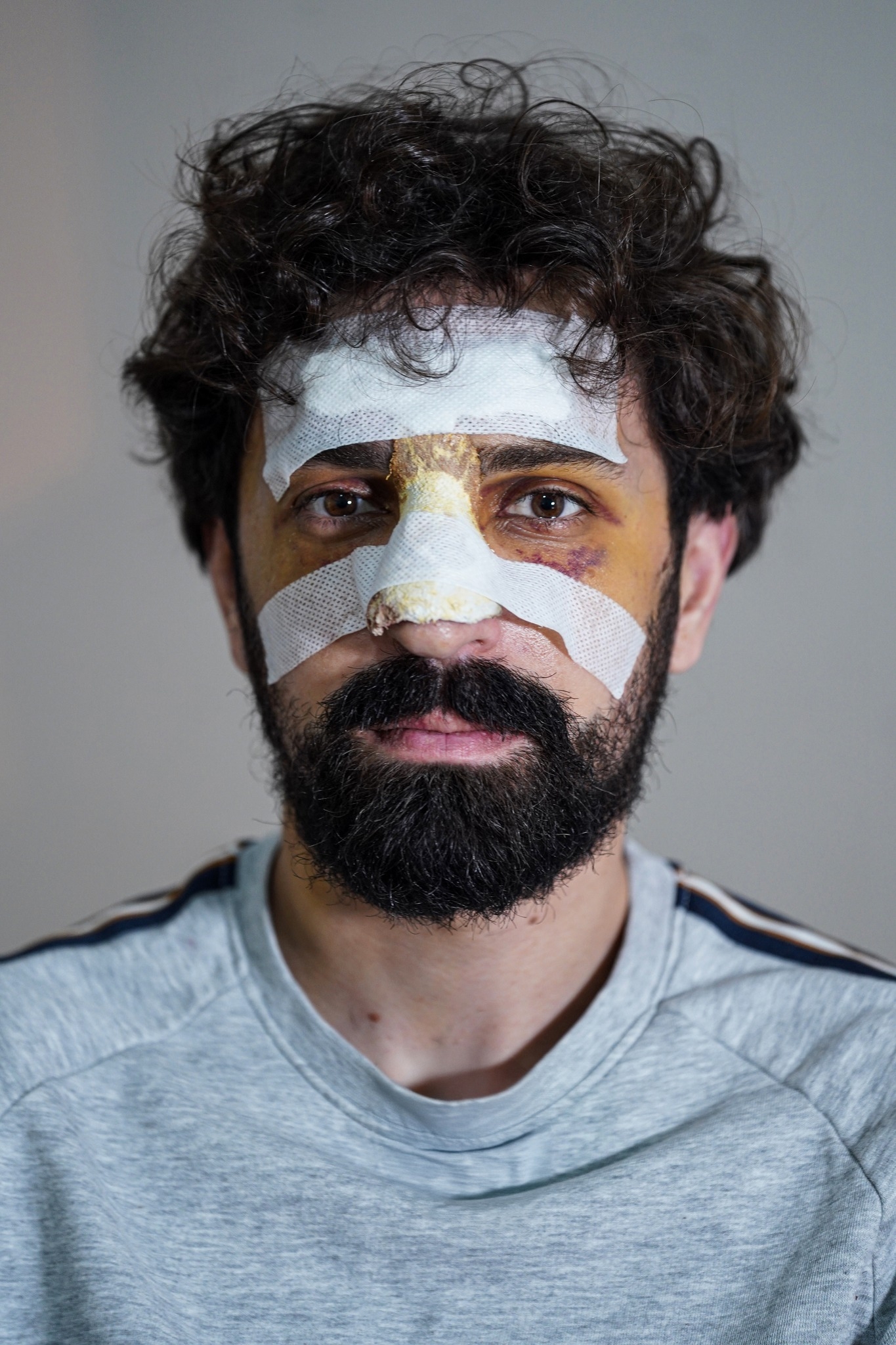 “პუბლიკას” რეპორტიორს, ალექსანდრე ქეშელაშვილს, სასამართლომ სიტყვიერი გაფრთხილება მისცა