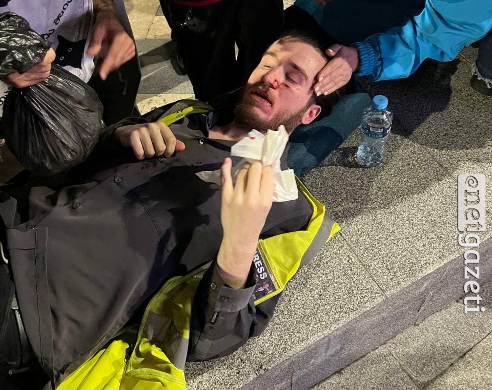 თბილისის მერის კახა კალაძის  საარჩევნო შტაბთან, პოლიციისა და “ქართული ოცნების” მხარდაჭერების მიერ, ექვსი ჟურნალისტი დაზარალდა